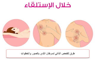 الفحص الذاتي لسرطان الثدي خلال الإستلقاء