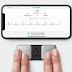  Dit ECG-accessoire kan drie hartritmestoornissen meten 