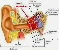 Obat Gendang Telinga Pecah 