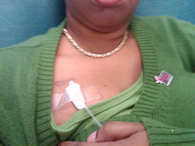 Nicole McLean (young african-american woman) receiving chemotherapy. Green sweater, picc line connected to port.