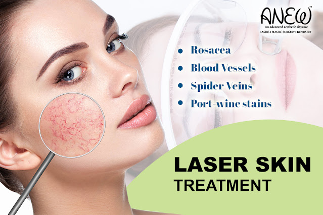 Laser Skin Treatment Bangalore