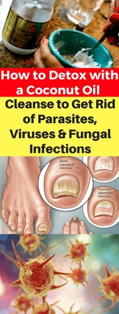 How To Detox & A Coconut Oil Cleanse To Get Rid Of Parasites, Viruses, & Fungal Infections!!!