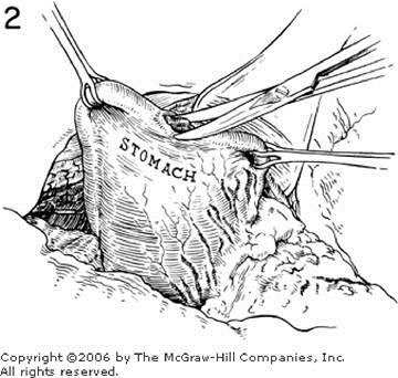 clip_image004