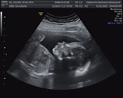It's a girl!