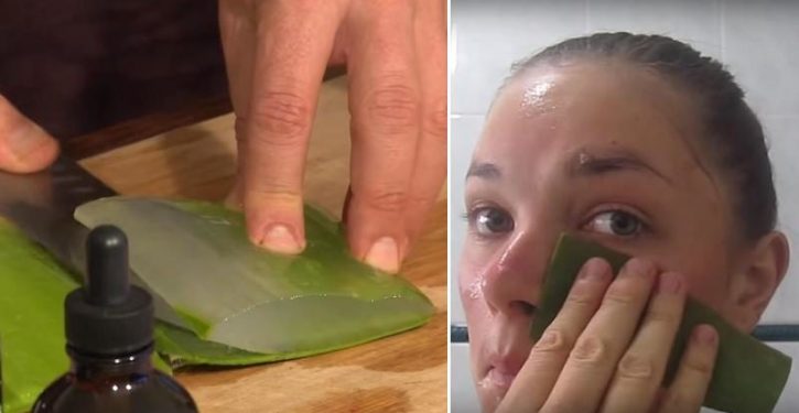 She Rubs Aloe Vera On Her Face For 7 Days And The Results Are Amazing!