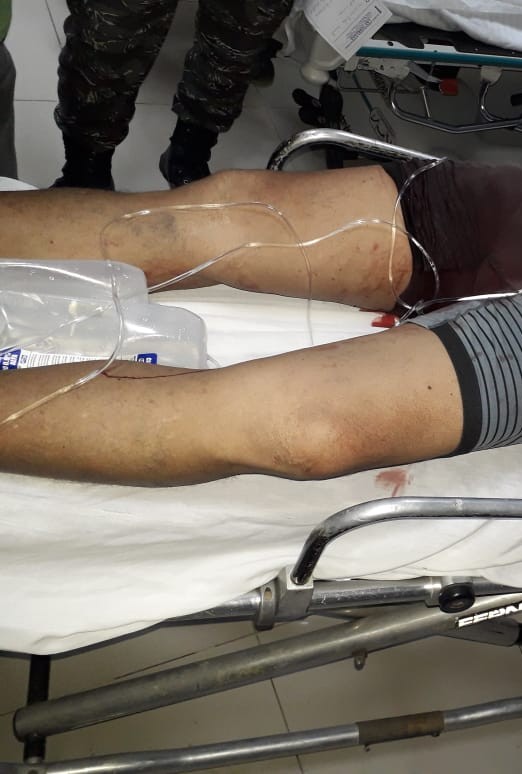  Antisociales hieren empresario en intento de atraco en Las Terrenas
