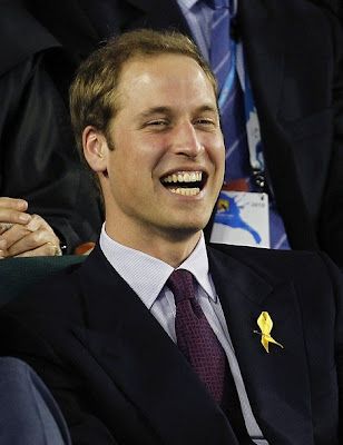 is prince william balding. prince william balding 2010.