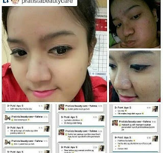 Testimoni cara efektif menghilangkan jerawat