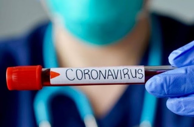 Jujuy sumo 170 nuevos casos positivos de Coronavirus 