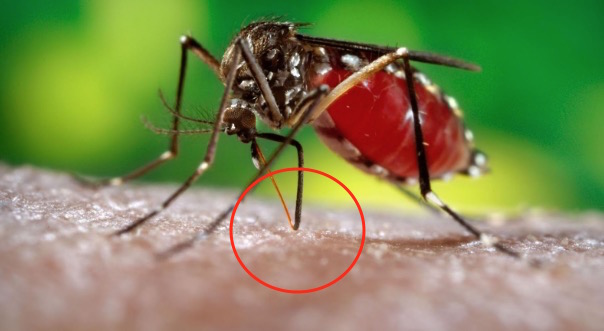 Saksikan Bagaimana Nyamuk Aedes Sedut Darah Manusia
