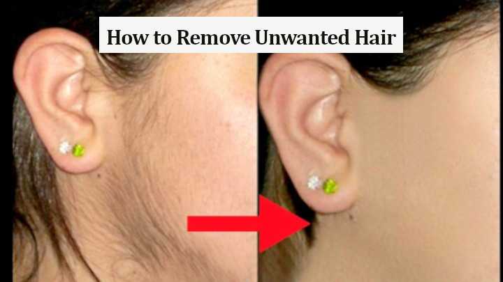 How-to-Remove-Unwanted-Hair