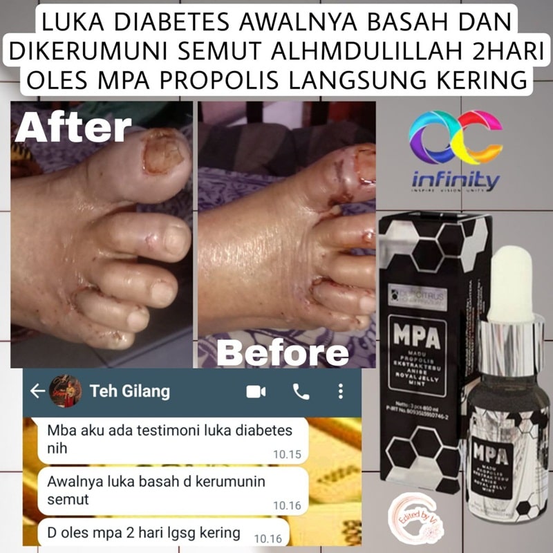 testimoni mpa propolis-63