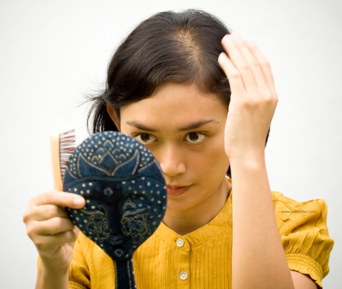 Solusi Sederhana Mengatasi Rambut Yang Menipis Pada Wanita Tips