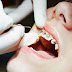 Niềng răng sai cách tại nha khoa không uy tín