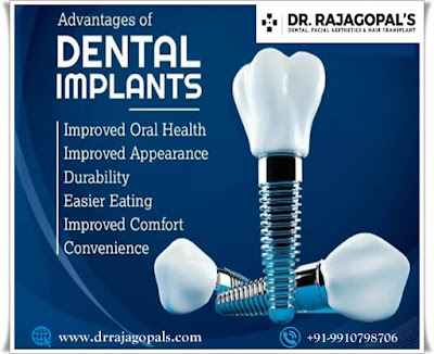 Dental Implant Treatment in Gurgaon