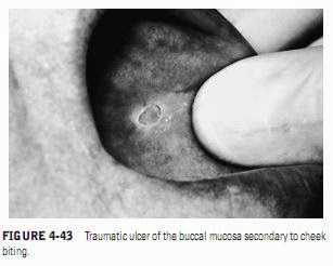 ORAL MANIFESTATIONS