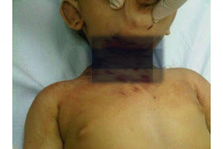 طفلة سعودية تقتل على يد أختها و السبب !!!
