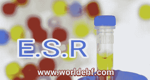 E.S.R OR Erethrocyte Sedimentation Rate