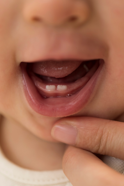 How Pediatric Dentistry Promotes Healthy Habits from an Early Age