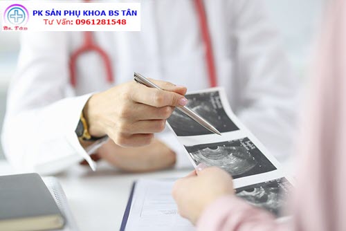 kích thước thai nhi theo tuần