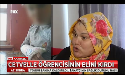 öğrencisinin elini kıran öğretmene 3 bin liralık ceza