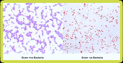 Gram positive and negative bacteria diagram, images