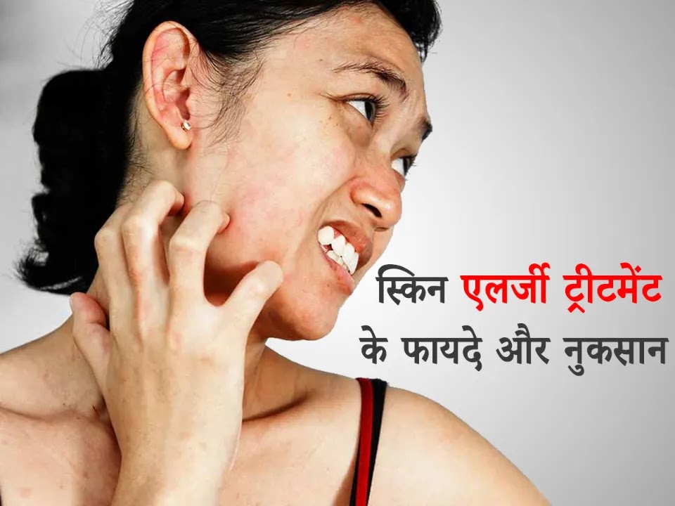 Skin Allergy Treatment at Home in Hindi