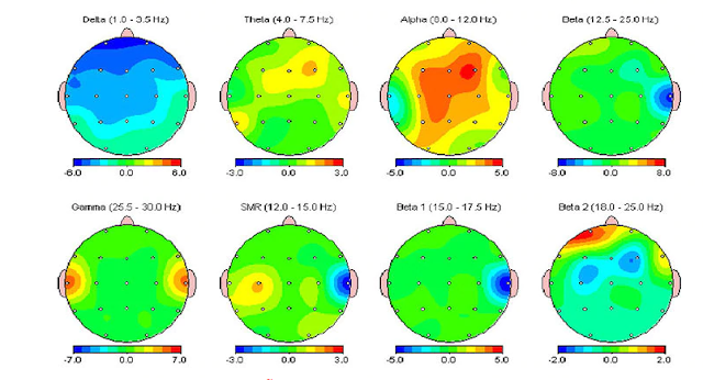 Cranial Electrotherapy Stimulation: Science and Evidence