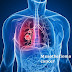 What Everyone Must Know About Mesothelioma Cancer 