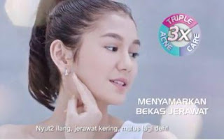 nama asli Model cewek cantik bintang Iklan Nutrafor Acne Gel