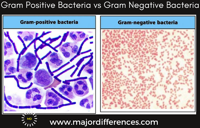 Gram Positive and Gram Negative Bacteria