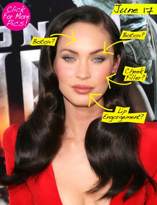 Megan Fox Plastic Surgery