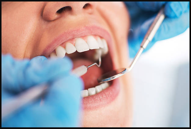 Oral Consideration Tips