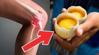 Как с 2 яйца напълно да премахнете болките в коленете и да "ремонтирате" ставите