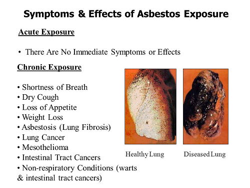 Asbestos Exposure Immediate Symptoms