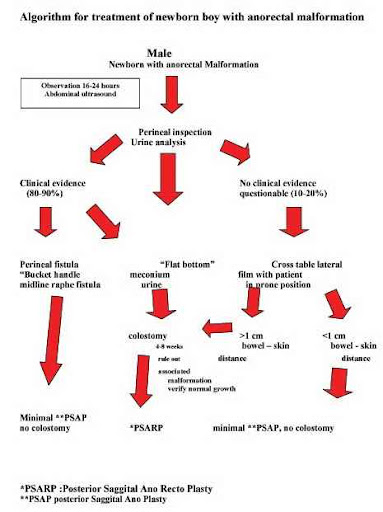 Bagan penatalaksanaan bayi dengan malformasi anorektal