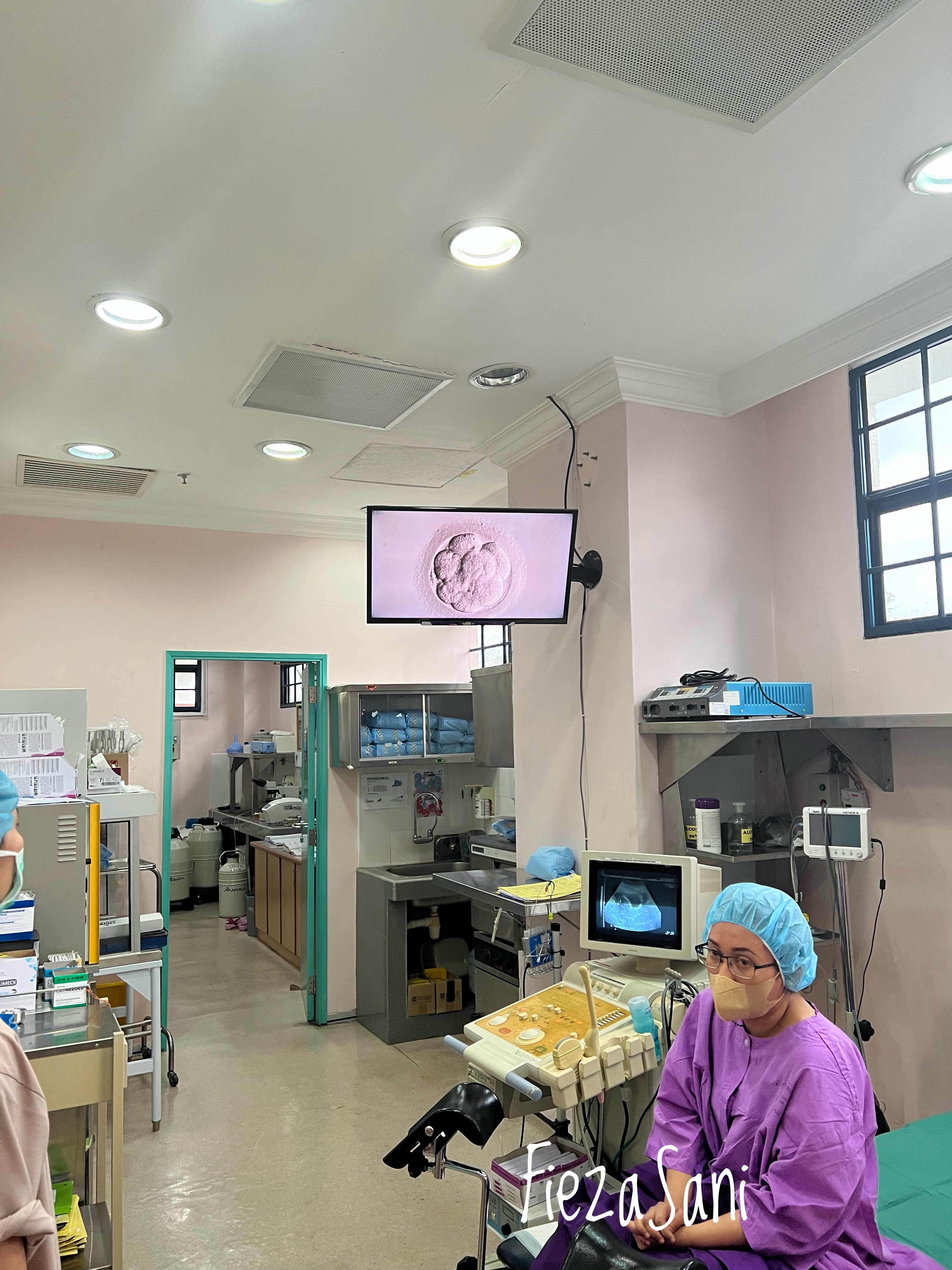 proses IVF,kaedah ivf, ovum pick up, embrio transfer