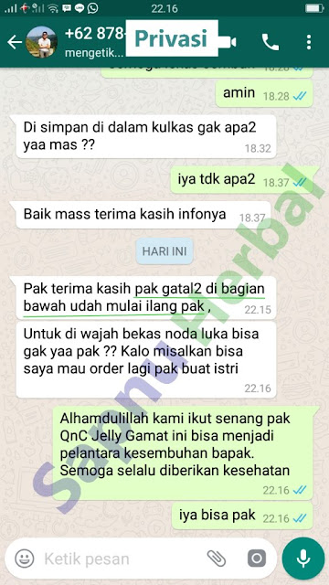 Cara Mengobati Gatal Di Ketiak Dan Selangkangan Secara Alami Terbukti Manjur ~ TESTIMONI QNC JELLY GAMAT