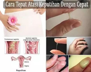 Obat Keputihan Bau Amis Di Apotik