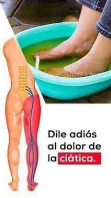 Truco casero para el dolor de la ciática