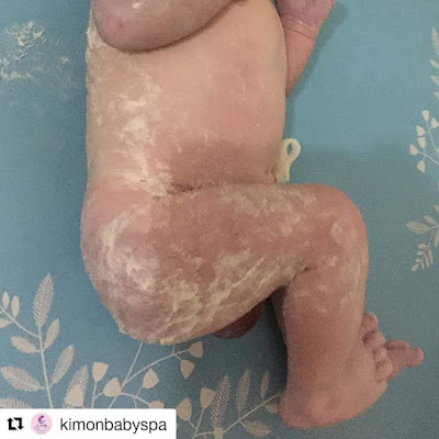 Mengenal Vernix Caseosa dan opini menyesatkan tentangnya.