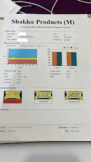 Kesan Makan Pil Kalsium Ostenutrix Shaklee Untuk Tulang