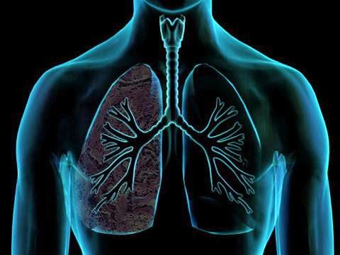 Tips menjaga paru paru agar tetap sehat