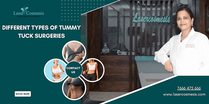 Different Types of Tummy Tuck Surgeries