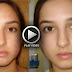 How Get Ride Acne From Face - Video Tutorial