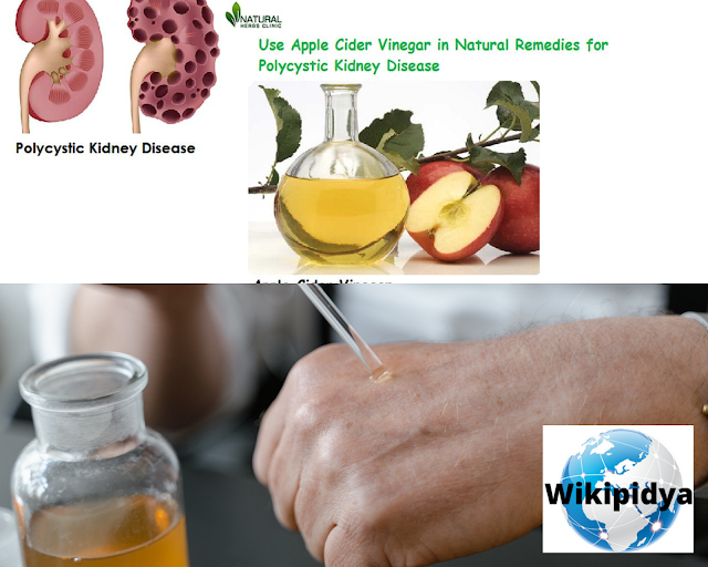 Benefits of Apple Cider Vinegar, its Ingredients, and how to make its
