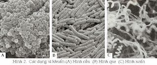 vi khuẩn kỵ khí không sinh nha bào