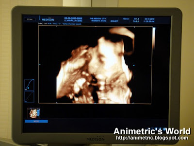 Black And White 4d Ultrasound. With 3D and 4D Ultrasound,