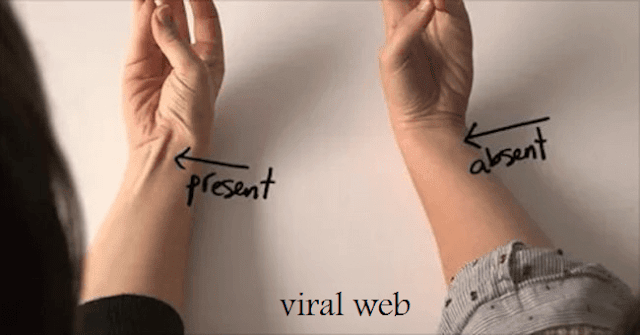 Does Your Tendon Pop Out Of Your Your Wrist Like This? If So, Here’s What It Means