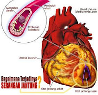 Kesehatan Jantung